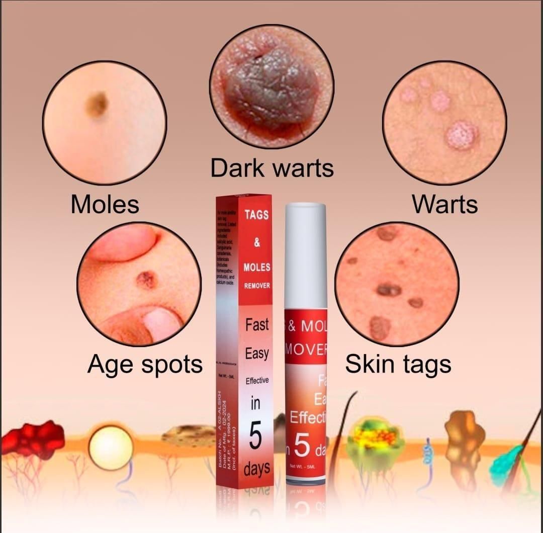 Skin Tag & Mole Remover Pen – Safe, Painless Skin Correction at Home