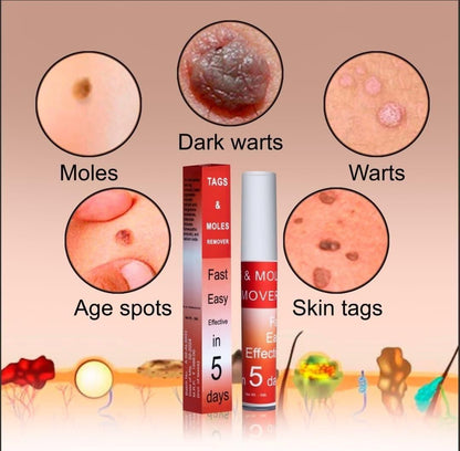 Skin Tag & Mole Remover Pen – Safe, Painless Skin Correction at Home